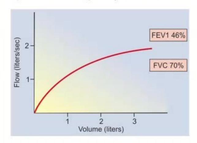 images/MNJ-P-OSCE 01. Data Interpretation_page_0_Figure_8.jpeg