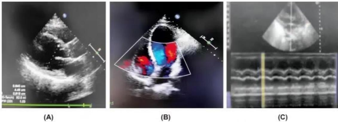 images/MNJ-P-OSCE 03. POCUS_page_1_Picture_3.jpeg