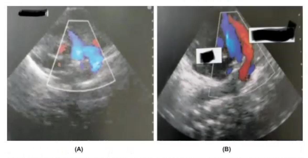 images/MNJ-P-OSCE 03. POCUS_page_1_Picture_9.jpeg