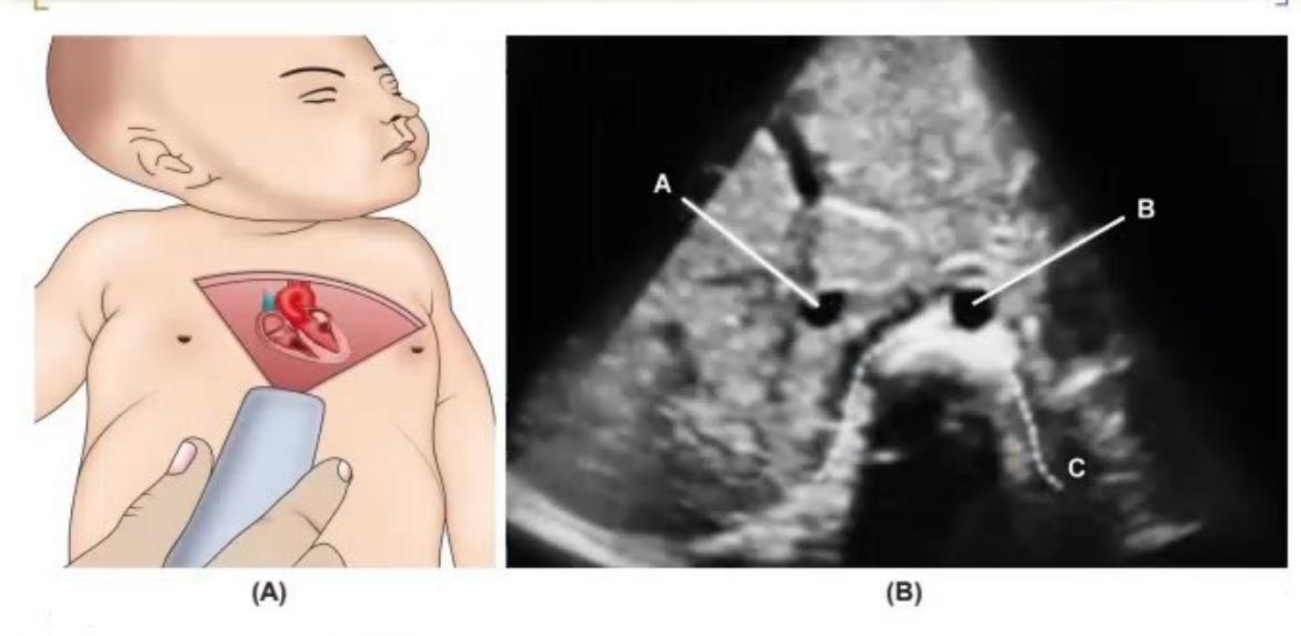 images/MNJ-P-OSCE 03. POCUS_page_2_Picture_2.jpeg
