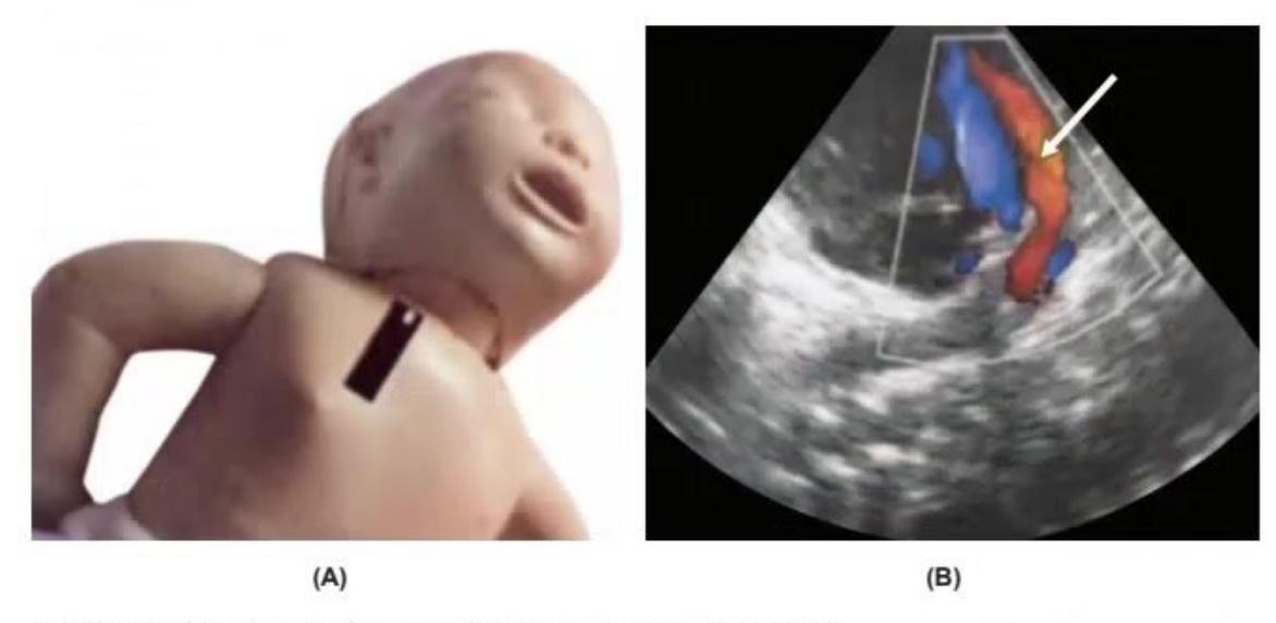 images/MNJ-P-OSCE 03. POCUS_page_2_Picture_7.jpeg