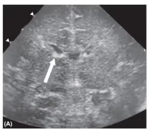 images/MNJ-P-OSCE 03. POCUS_page_3_Picture_7.jpeg