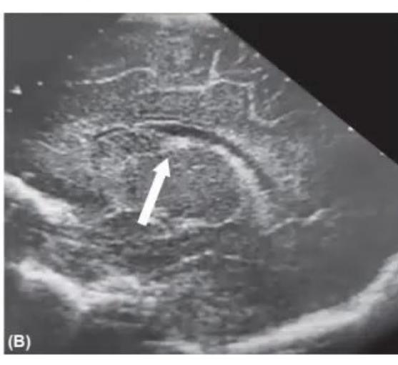 images/MNJ-P-OSCE 03. POCUS_page_3_Picture_8.jpeg