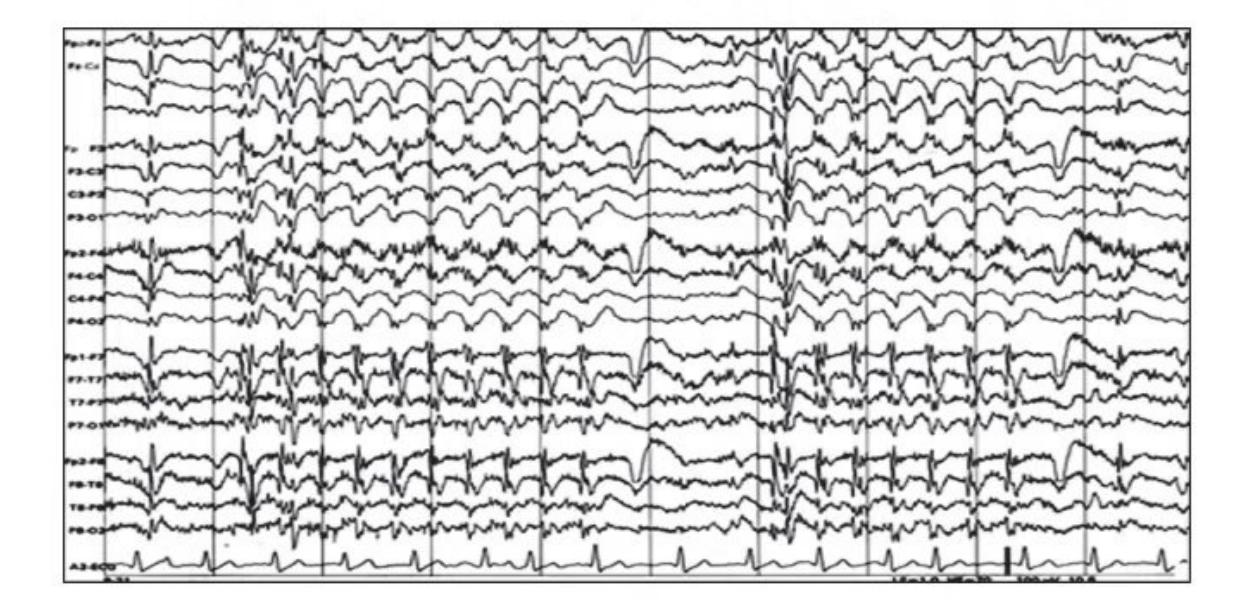 images/MNJ-P-OSCE 04. Blood gas and electrophysiology_page_10_Figure_10.jpeg