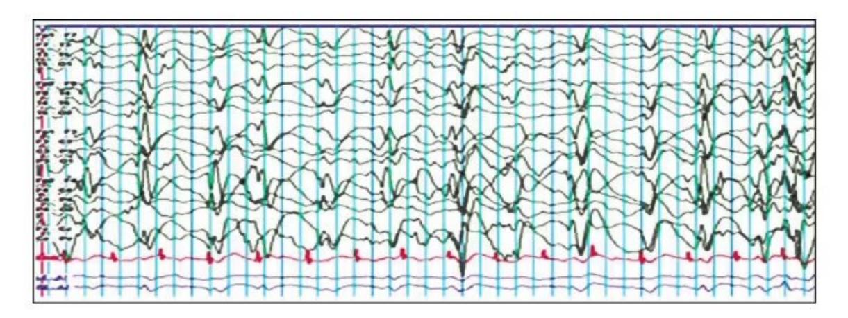 images/MNJ-P-OSCE 04. Blood gas and electrophysiology_page_10_Figure_6.jpeg