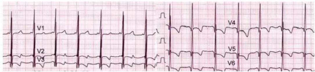 images/MNJ-P-OSCE 04. Blood gas and electrophysiology_page_11_Figure_10.jpeg