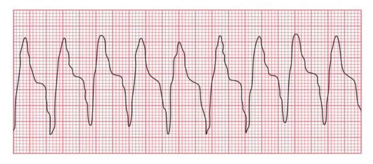 images/MNJ-P-OSCE 04. Blood gas and electrophysiology_page_11_Figure_16.jpeg