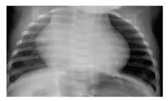 images/MNJ-P-OSCE 04. Blood gas and electrophysiology_page_11_Picture_9.jpeg