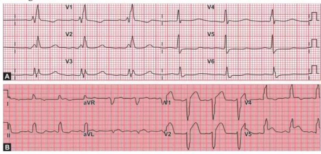 images/MNJ-P-OSCE 04. Blood gas and electrophysiology_page_12_Figure_11.jpeg
