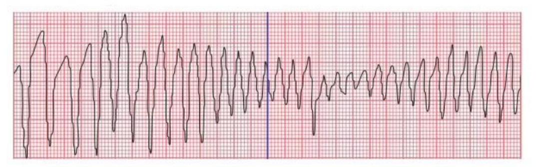 images/MNJ-P-OSCE 04. Blood gas and electrophysiology_page_12_Figure_7.jpeg