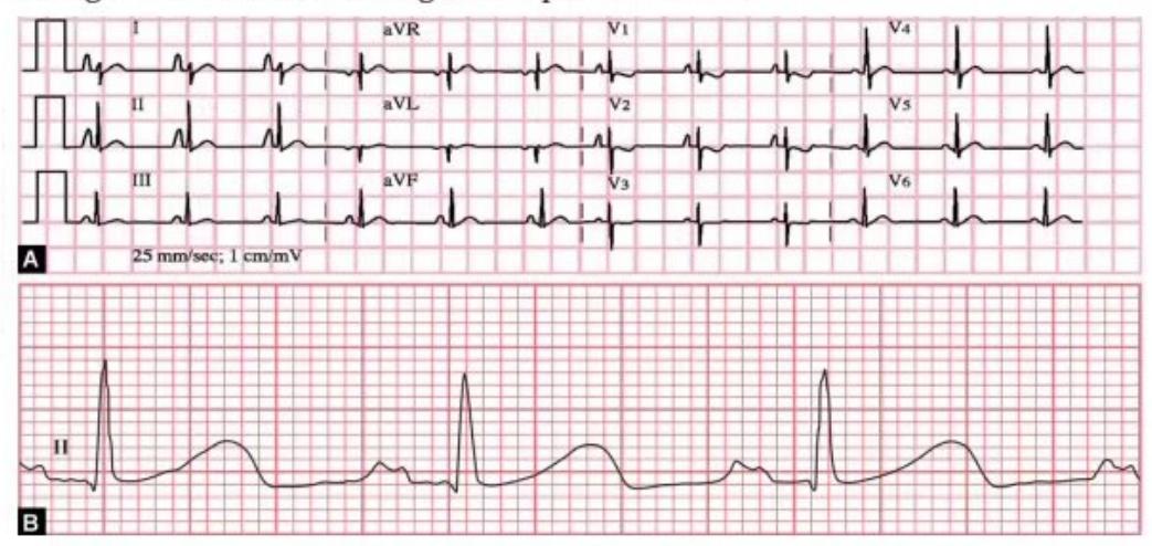 images/MNJ-P-OSCE 04. Blood gas and electrophysiology_page_12_Figure_9.jpeg