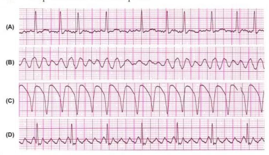 images/MNJ-P-OSCE 04. Blood gas and electrophysiology_page_13_Figure_15.jpeg