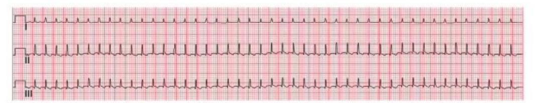images/MNJ-P-OSCE 04. Blood gas and electrophysiology_page_13_Picture_9.jpeg