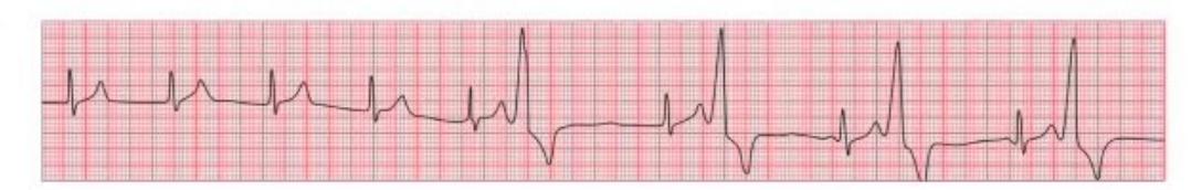 images/MNJ-P-OSCE 04. Blood gas and electrophysiology_page_14_Figure_2.jpeg