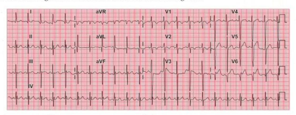 images/MNJ-P-OSCE 04. Blood gas and electrophysiology_page_14_Figure_6.jpeg