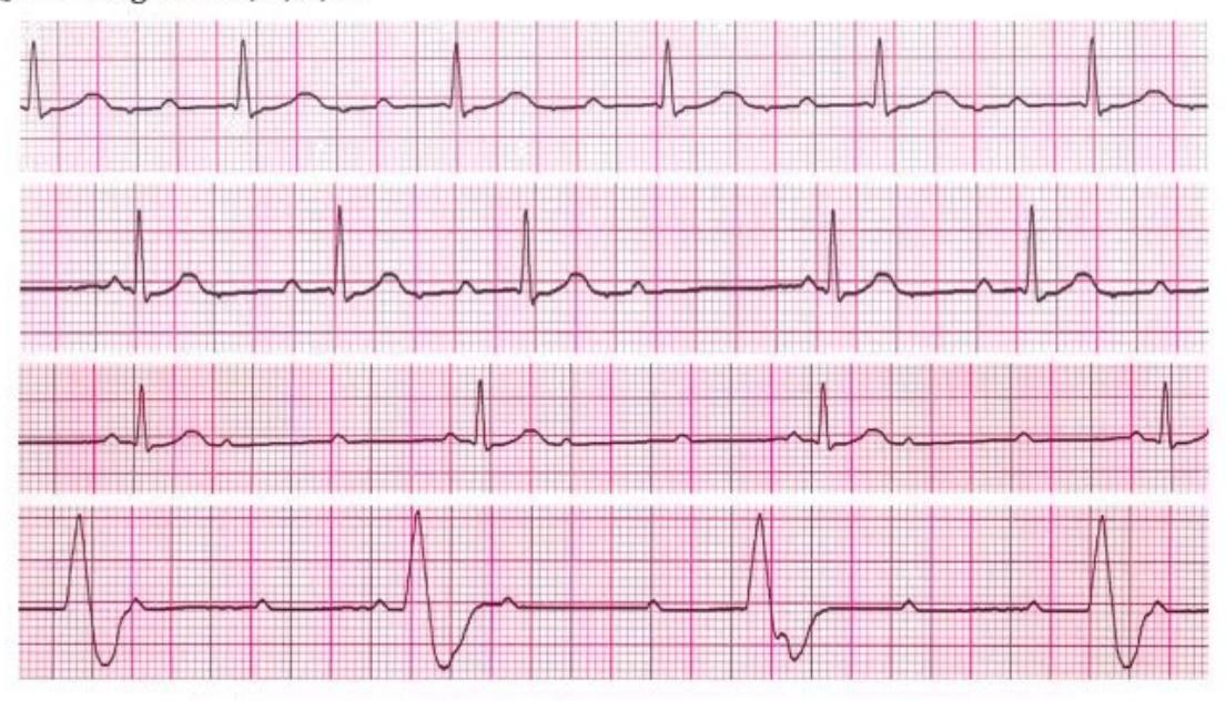 images/MNJ-P-OSCE 04. Blood gas and electrophysiology_page_14_Figure_8.jpeg