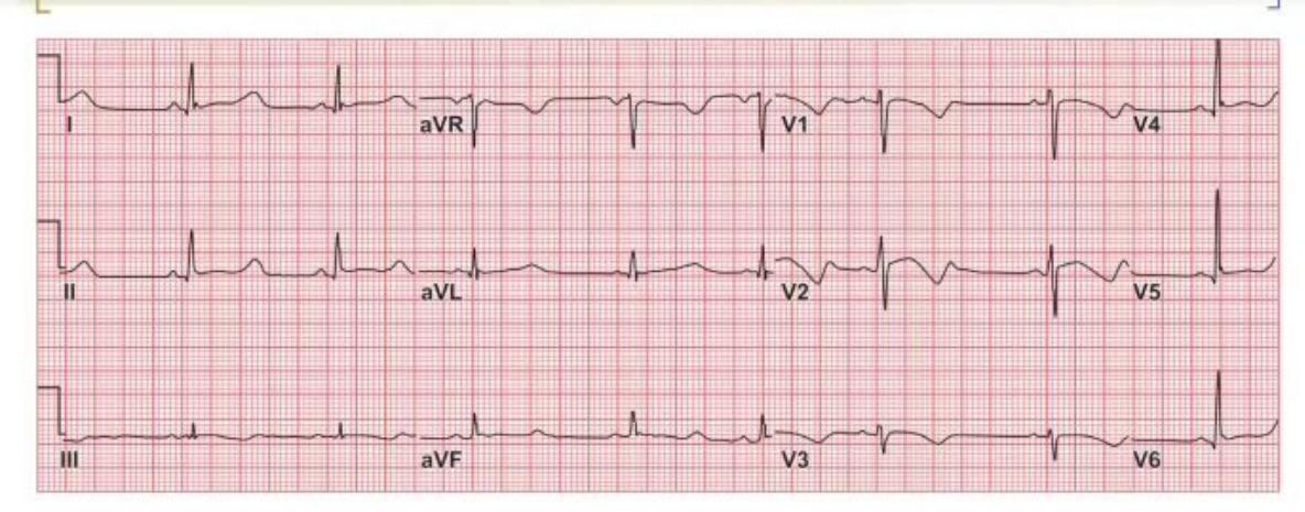 images/MNJ-P-OSCE 04. Blood gas and electrophysiology_page_15_Figure_2.jpeg