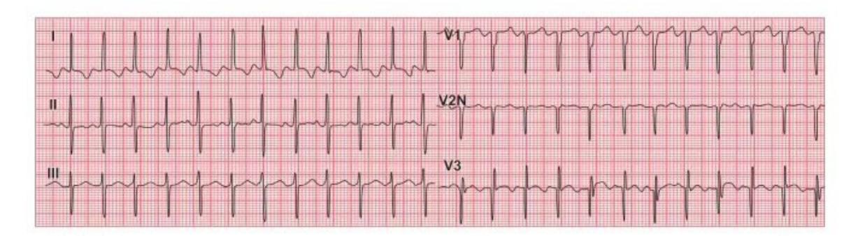 images/MNJ-P-OSCE 04. Blood gas and electrophysiology_page_15_Figure_8.jpeg