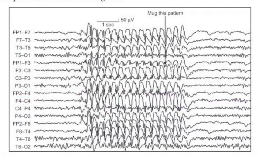 images/MNJ-P-OSCE 04. Blood gas and electrophysiology_page_7_Figure_38.jpeg
