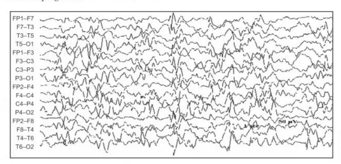 images/MNJ-P-OSCE 04. Blood gas and electrophysiology_page_8_Figure_12.jpeg