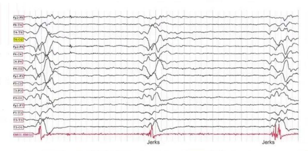 images/MNJ-P-OSCE 04. Blood gas and electrophysiology_page_8_Figure_6.jpeg