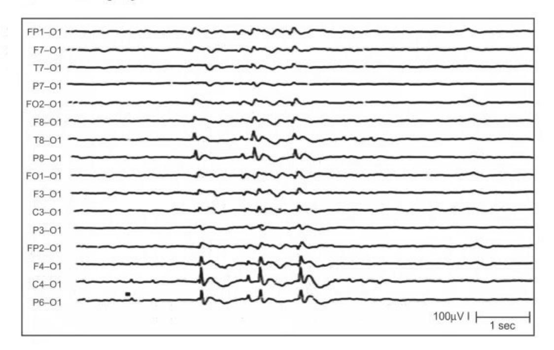 images/MNJ-P-OSCE 04. Blood gas and electrophysiology_page_9_Figure_12.jpeg