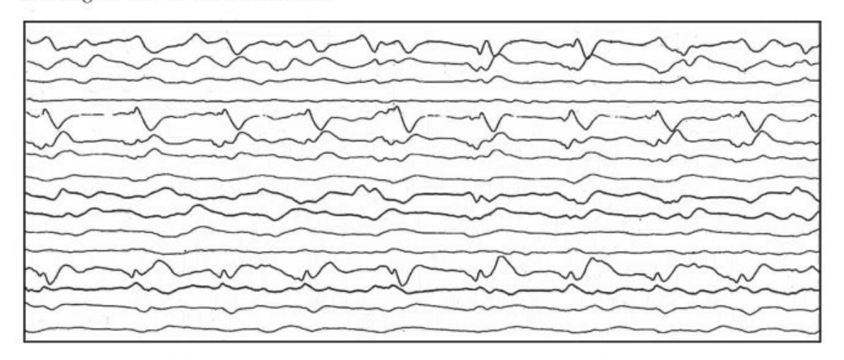 images/MNJ-P-OSCE 04. Blood gas and electrophysiology_page_9_Figure_7.jpeg