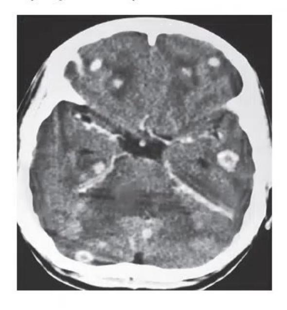 images/MNJ-P-OSCE 05. Neuroimaging_page_10_Picture_7.jpeg