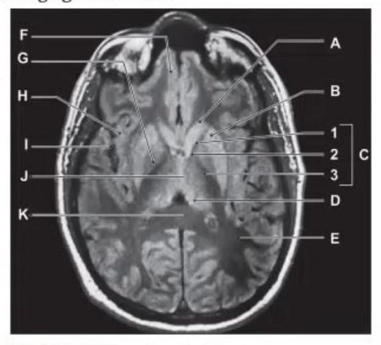 images/MNJ-P-OSCE 05. Neuroimaging_page_3_Picture_3.jpeg