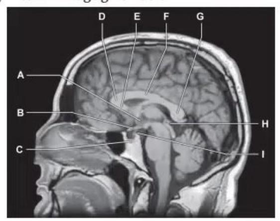 images/MNJ-P-OSCE 05. Neuroimaging_page_3_Picture_5.jpeg
