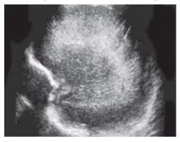 images/MNJ-P-OSCE 05. Neuroimaging_page_3_Picture_7.jpeg