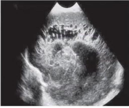 images/MNJ-P-OSCE 05. Neuroimaging_page_3_Picture_8.jpeg