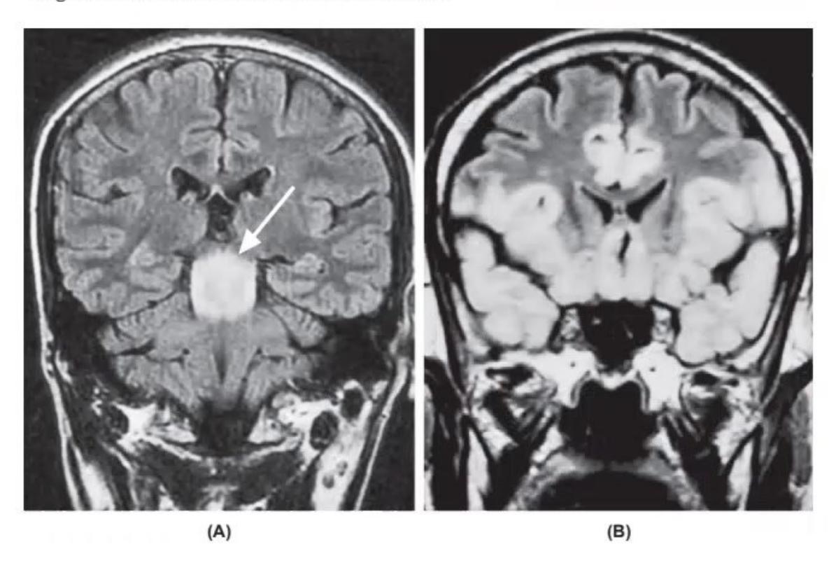 images/MNJ-P-OSCE 05. Neuroimaging_page_4_Picture_11.jpeg