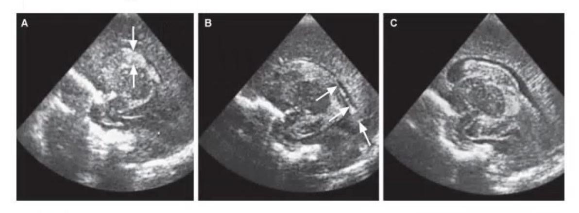 images/MNJ-P-OSCE 05. Neuroimaging_page_4_Picture_9.jpeg