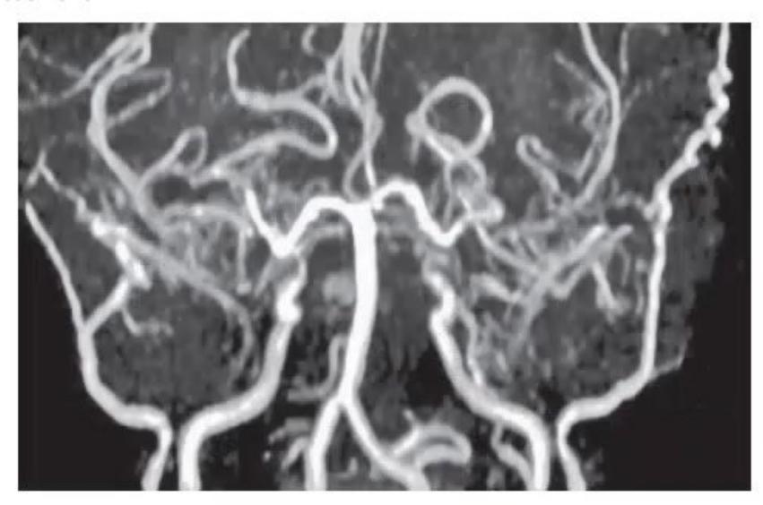 images/MNJ-P-OSCE 05. Neuroimaging_page_5_Picture_10.jpeg