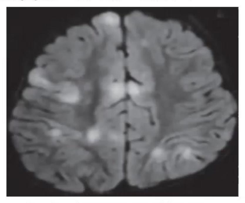 images/MNJ-P-OSCE 05. Neuroimaging_page_5_Picture_5.jpeg