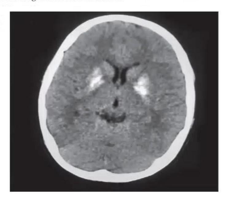 images/MNJ-P-OSCE 05. Neuroimaging_page_6_Picture_5.jpeg