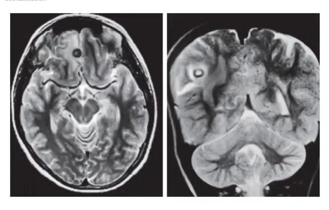 images/MNJ-P-OSCE 05. Neuroimaging_page_6_Picture_9.jpeg