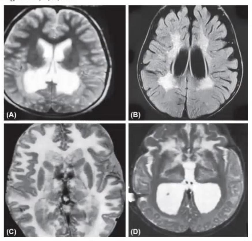images/MNJ-P-OSCE 05. Neuroimaging_page_7_Picture_4.jpeg
