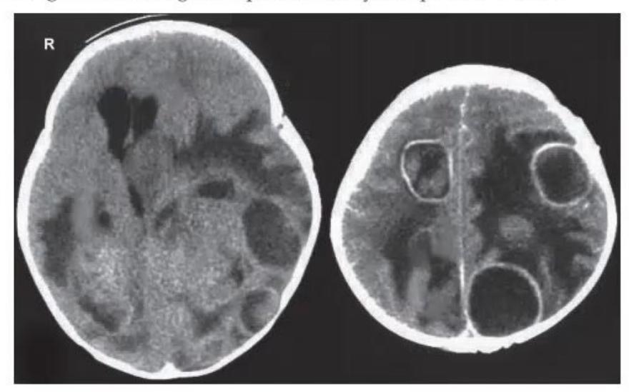 images/MNJ-P-OSCE 05. Neuroimaging_page_7_Picture_9.jpeg