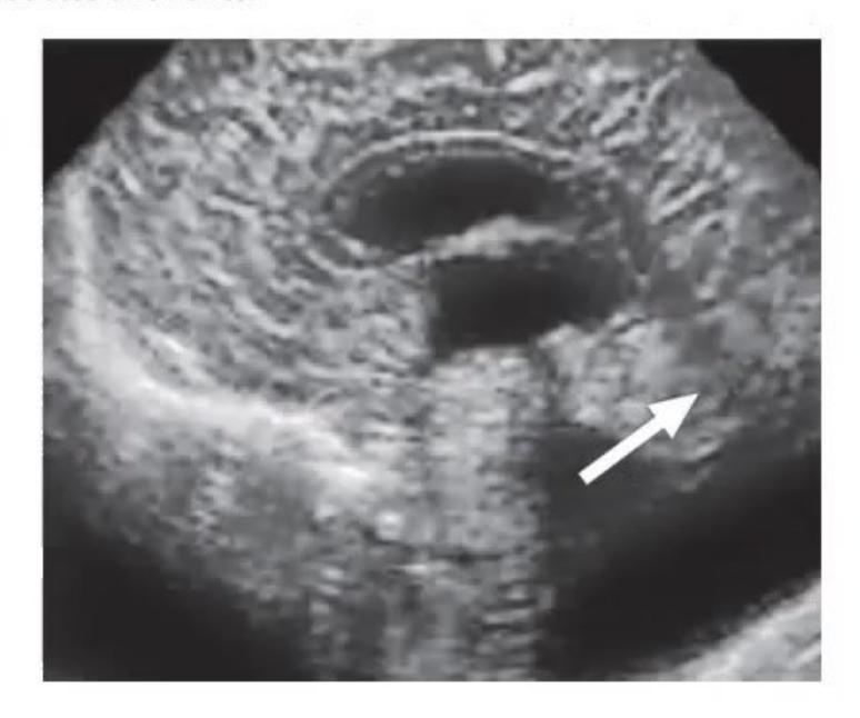 images/MNJ-P-OSCE 05. Neuroimaging_page_8_Picture_11.jpeg