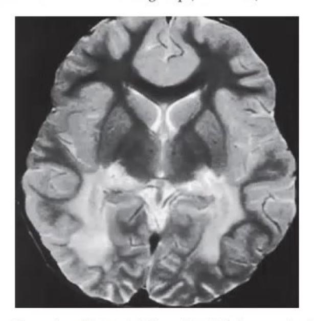 images/MNJ-P-OSCE 05. Neuroimaging_page_8_Picture_6.jpeg