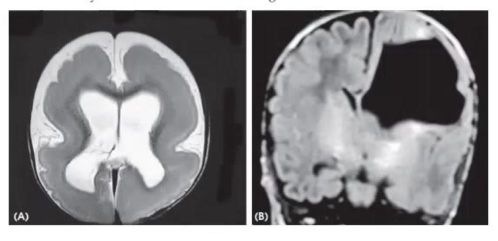 images/MNJ-P-OSCE 05. Neuroimaging_page_9_Picture_11.jpeg