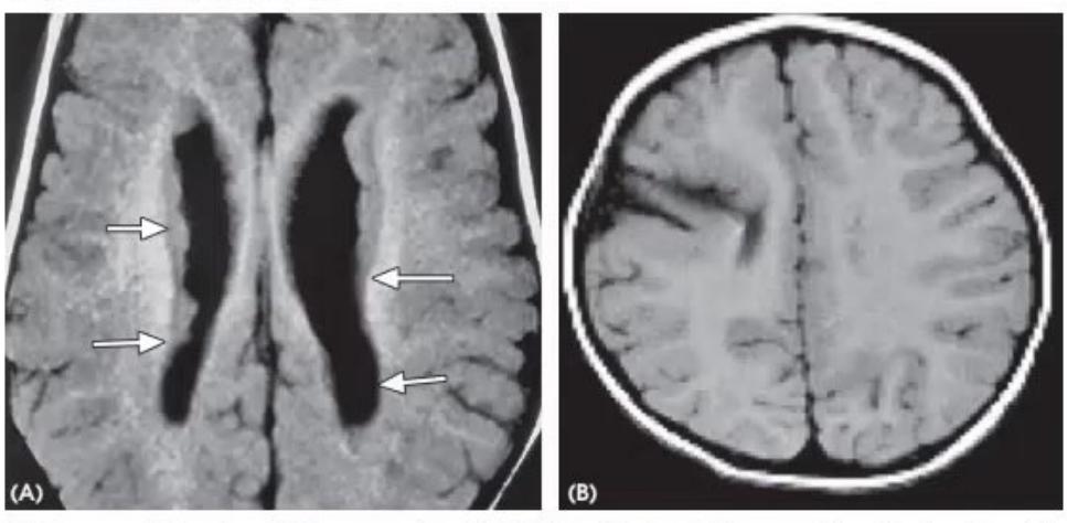 images/MNJ-P-OSCE 05. Neuroimaging_page_9_Picture_3.jpeg