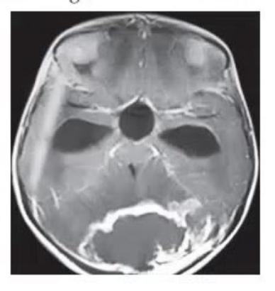 images/MNJ-P-OSCE 05. Neuroimaging_page_9_Picture_7.jpeg