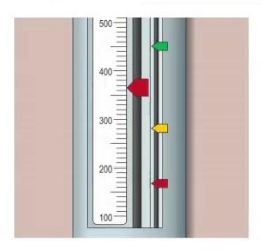images/MNJ-P-OSCE 06. Audiometry, capnogram, spirometry_page_10_Picture_11.jpeg