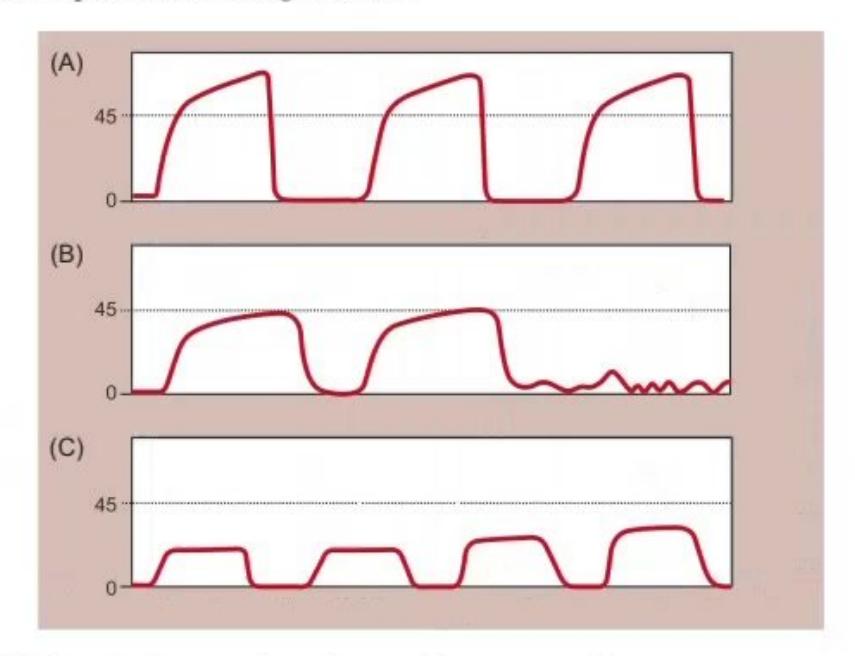 images/MNJ-P-OSCE 06. Audiometry, capnogram, spirometry_page_6_Figure_6.jpeg