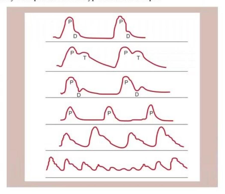 images/MNJ-P-OSCE 06. Audiometry, capnogram, spirometry_page_6_Figure_8.jpeg