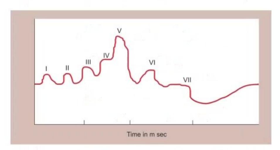 images/MNJ-P-OSCE 06. Audiometry, capnogram, spirometry_page_7_Figure_7.jpeg