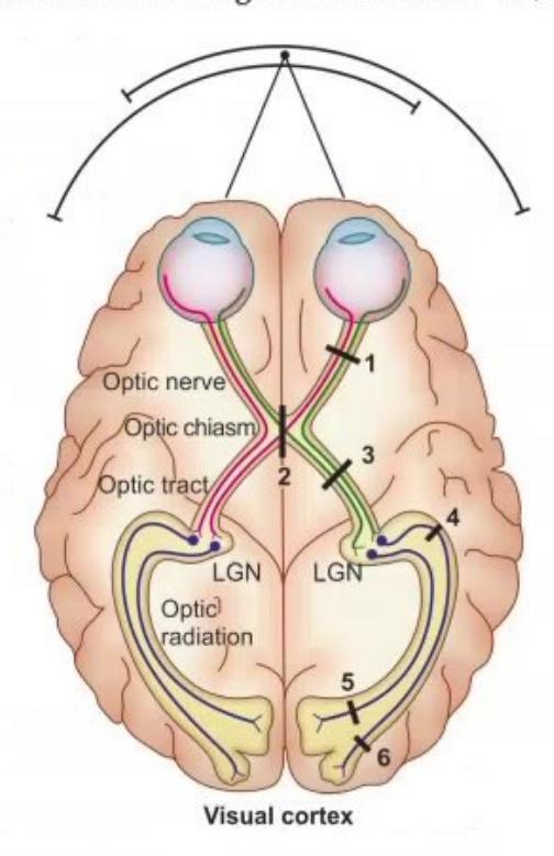 images/MNJ-P-OSCE 06. Audiometry, capnogram, spirometry_page_7_Picture_3.jpeg